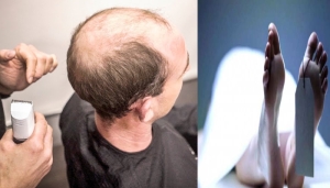hair fixing