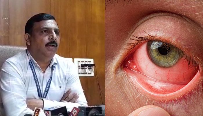 red eye disease