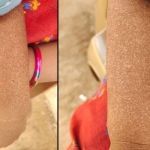 spot disease