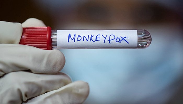 monkeypox