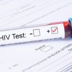 hiv