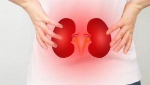 Kidney failure