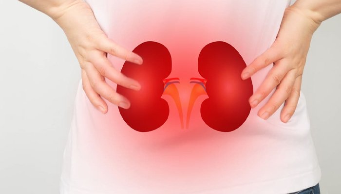 Kidney failure