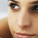 dark circles under eyes