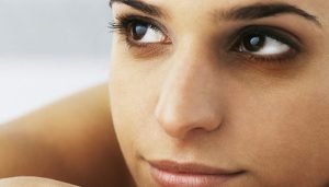dark circles under eyes